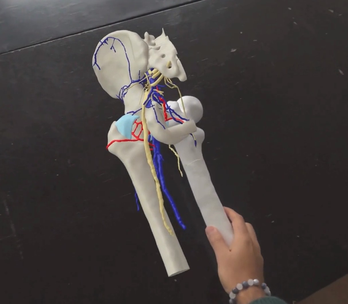 HoloMedicine Simulation: mixed-reality 3D anatomy overlaid on a physical model